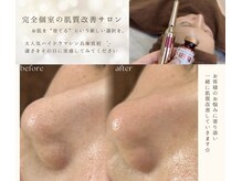 ビーグロウ(be Grow)