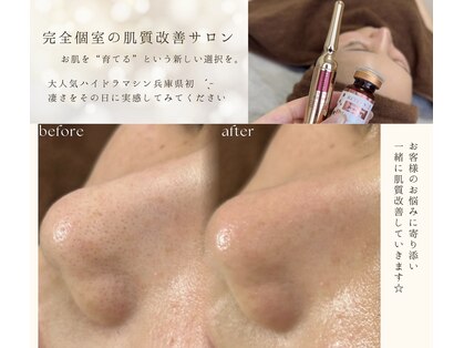 ビーグロウ(be Grow)の写真