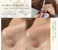 ビーグロウ(be Grow)