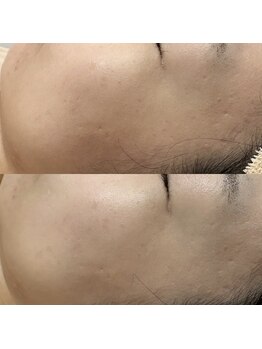 アミュレット(amulette)/ツルッとしたお肌へ♪