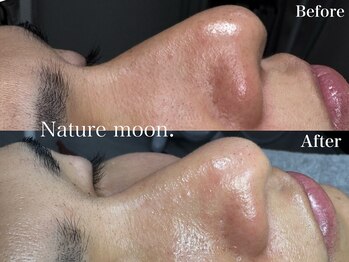 ナチュールムーン(Nature moon.)/毛穴洗浄