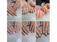 アレーズネイル(A'laise Nail)