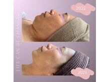 リラブルー(Lilas Bleu)の雰囲気（リラ・ブルー歴3年目のお客様の変化！継続ケアが人生を変える！）