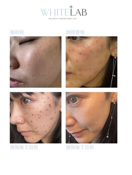 サロンドダリア(Salon de Dahlia)の写真/5年後、もっと輝く素肌へ！最新シミケア×ビタミンA導入で、今ある肌悩みと未来のエイジングを同時に解決◎