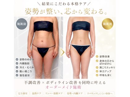 ココベルプラス(CoCo Bellepuls)の写真