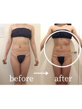 ボーレーヴ(beau reve)/ブライダル/インディバ/痩身