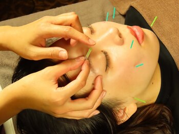 アジアンリラクゼーション ヴィラ 東札幌店(asian relaxation villa)/【当店限定】美容鍼