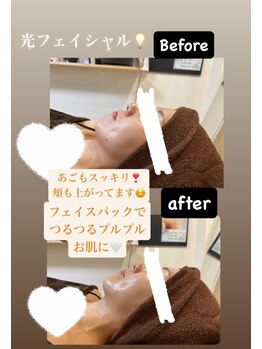サロン ルアナ(salon luana)/光フェイシャル