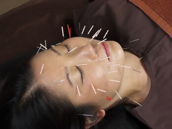 リッチョ鍼灸院(Riccio鍼灸院)の写真/【お子様同伴可】美容鍼に特化した鍼灸サロンで、ハリ艶UP＆くすみ・シワを改善！小顔効果も！新規5000円◎