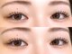 ライラ(LAiLA)の写真/【亀有駅から徒歩2分!】目元の印象を変えたい方必見◎丁寧なカウンセリングで初めての方にもオススメ