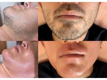 スプランドゥール(Splendeur)の雰囲気（40代～始める脱毛、お任せください◎当店は結果重視サロンです！）