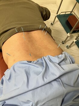 オリエンタル鍼灸マッサージ治療院の写真/【腰痛・足の痛み・しびれを改善】筋肉の構造と神経の走行を考え施術いたします。繰り返すつらい痛みにも◎