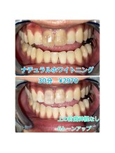 プラチナムビューティー 川口駅前店(PLATINUM BEAUTY)/長年気になっていたお悩み解決