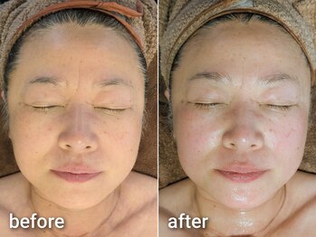 ミューク 自由が丘(mjuk)/細胞活性化セルラムフェイシャル