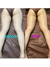 ラ シルク(La silk)/ハイパーナイフ下半身