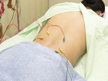 キュアハンズ 大森/腰部に鍼を