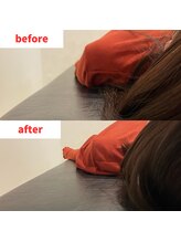 ナオル整体 福岡香椎院(NAORU整体)/20代女性施術事例【巻肩改善】