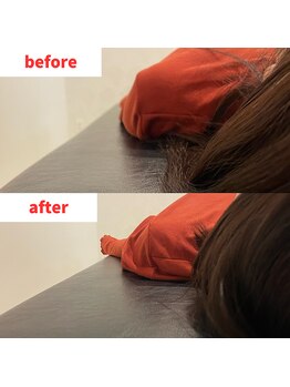 ナオル整体 福岡香椎院(NAORU整体)/20代女性施術事例【巻肩改善】