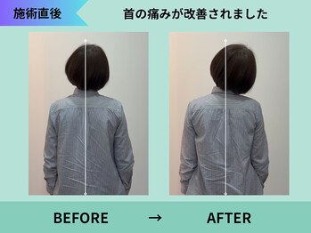 トミーリハ整体院(TOMMY REHA整体院)/振り向いた時の痛み改善