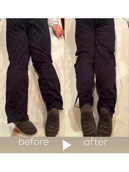 ディライト 小黒川店(D-LIGHT)/骨格ケアでまっすぐ美脚へ