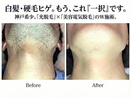 チャームプラス(CHARM+)の写真