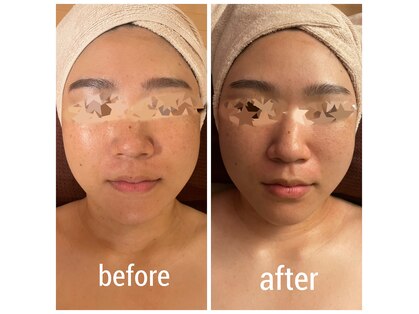 ディグニータココ 自由が丘(DIGNITA coco)の写真