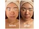 ディグニータココ 自由が丘(DIGNITA coco)の写真