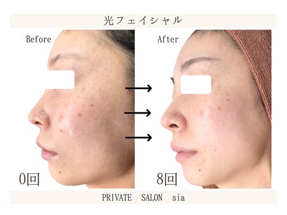 シア(sia)の写真