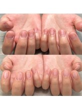 エルミュ(elmu)/自爪風仕上げ