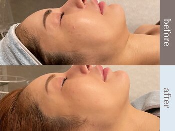 ビューティースタジオ韓美 渋谷店/お客様のbefore/after