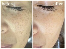 エイミー 名古屋駅前店(eimy.)/ララピール/名古屋