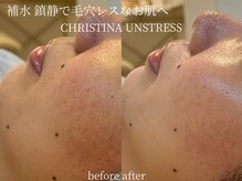 シェア(share.)/赤み鎮静 アンストレス