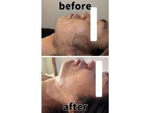 メンズの肌ケアもお任せください☆