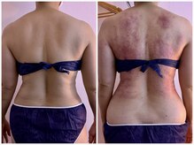 イーリバイブ/iNVYDOM MAX