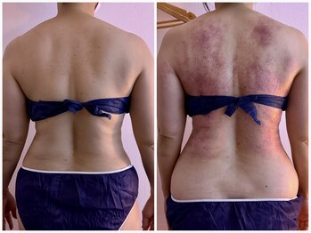 イーリバイブ/iNVYDOM MAX