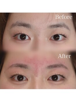 神戸のまゆげ屋さん 摂津本山 岡本店/眉毛WAX+間引き