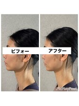ルーツ 熊本院(Roots)/美容ばり