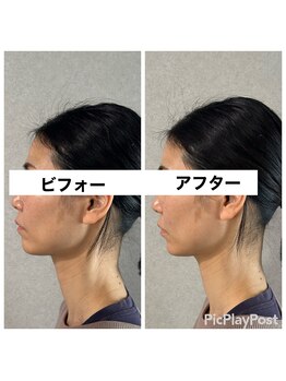 ルーツ 熊本院(Roots)/美容ばり