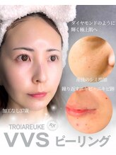 エイル(EILE)/VVSピーリング