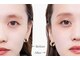 ユアン(u.an)の写真