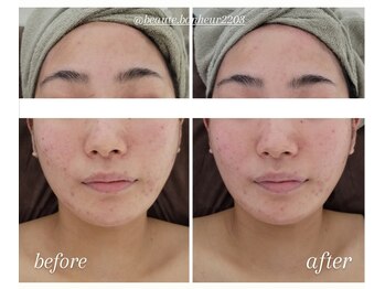 ボーテボナー(Beaute Bonheur)/♪フェイシャル♪