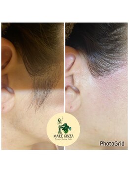 マイレ 銀座(MAILE)/もみあげ