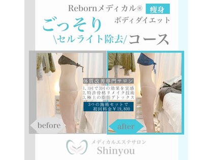 シンユウ(Shinyou)の写真