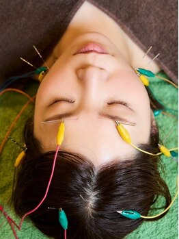 久心宝鍼灸院/通電美容鍼