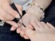 ネイル サロン アールズ ネイル(R's nail)の写真/ご自身の爪にずっと悩んでいた方に…韓国発★機能性ジェル"HeySwitch"で最新巻き爪ケア◎