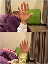 ヴィラ整骨院/手指の痛み・シビレの改善にも◎