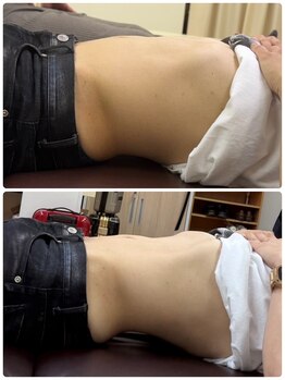 浜町しあわせ整体院/魔法の腸もみ