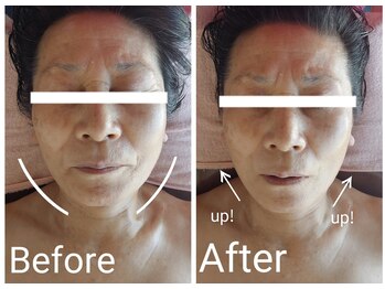 ニワ(Niwa)/ヘッド施術結果