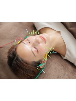 鍼灸施術を受けたい