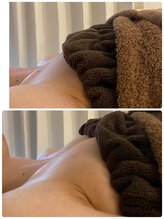 スマイルクルー(SmileClue)/初回ビフォーアフター症例